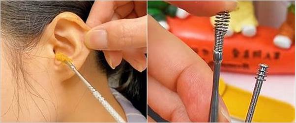 Best ear wax removal tools 2024